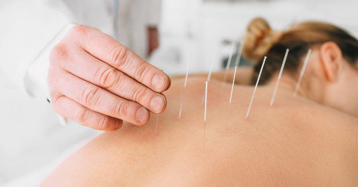 Comfort and hygiene are two important factors to consider in finding an acupuncture clinic.