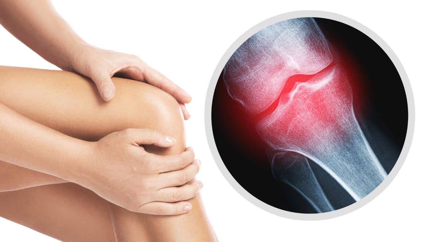 Arthritis Pain: Causes, Symptoms, Diagnosis & Treatment